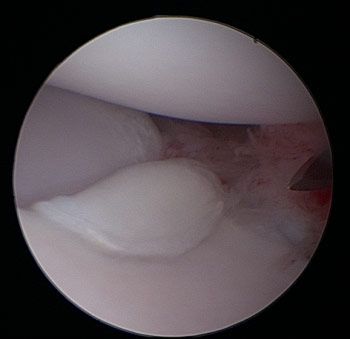 What is the inside of the elbow called?