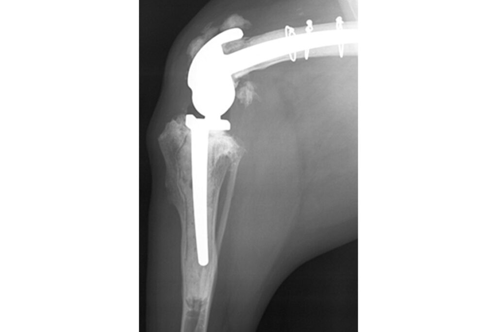 Canine custom total knee replacement Radiograph of custom total knee replacement implants.