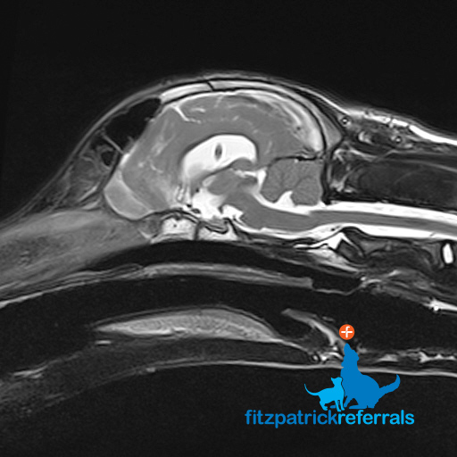 MRI scan of 6-month-old puppy's brain 5 weeks after surgery for hydrocephalus & having a ventricular to peritoneal shunt fitted