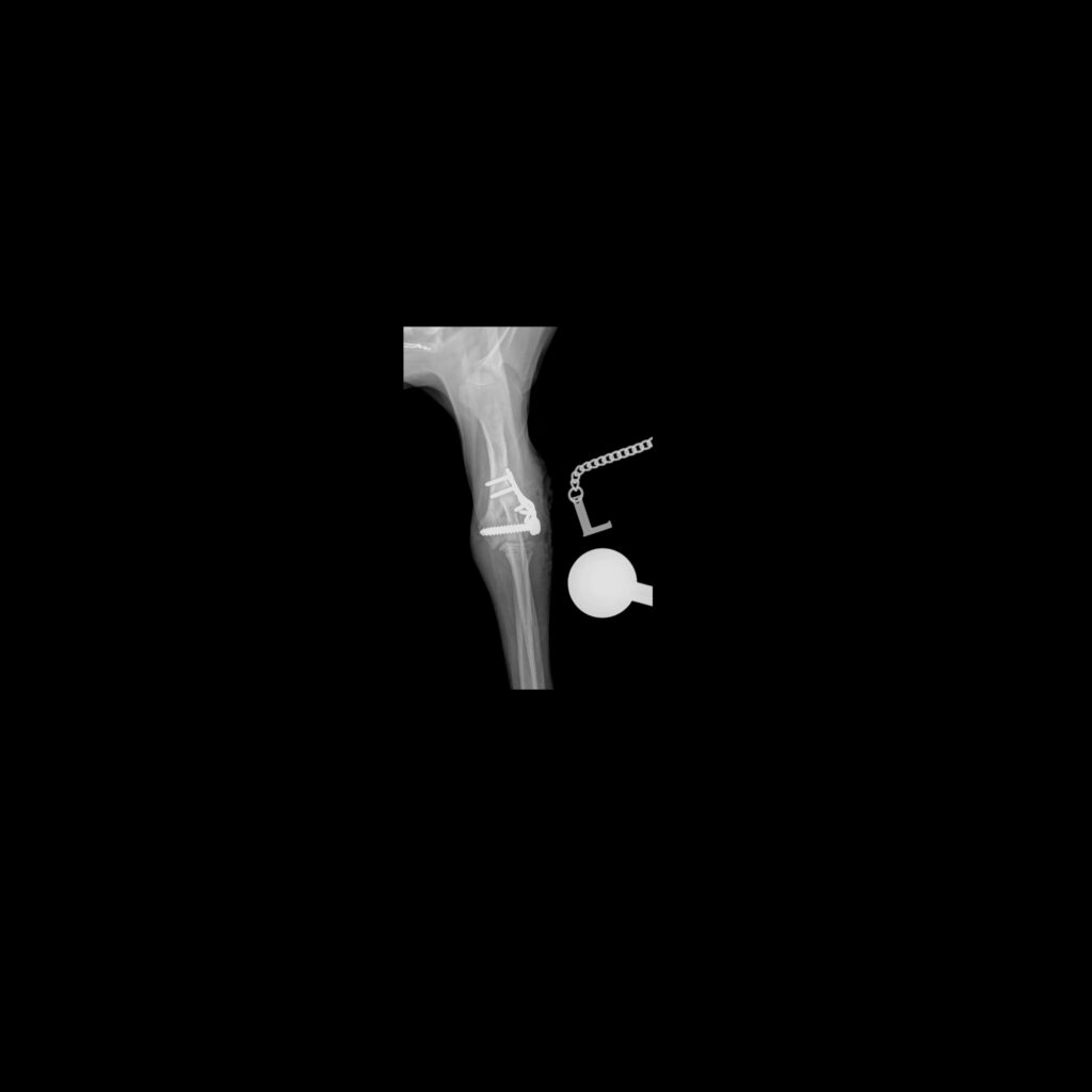 Radiograph of a condular fracture post-surgery at Fitzpatrick Referrals