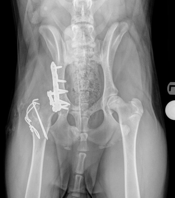 Radiograph of a pelvic fracture before and after specialist surgery
