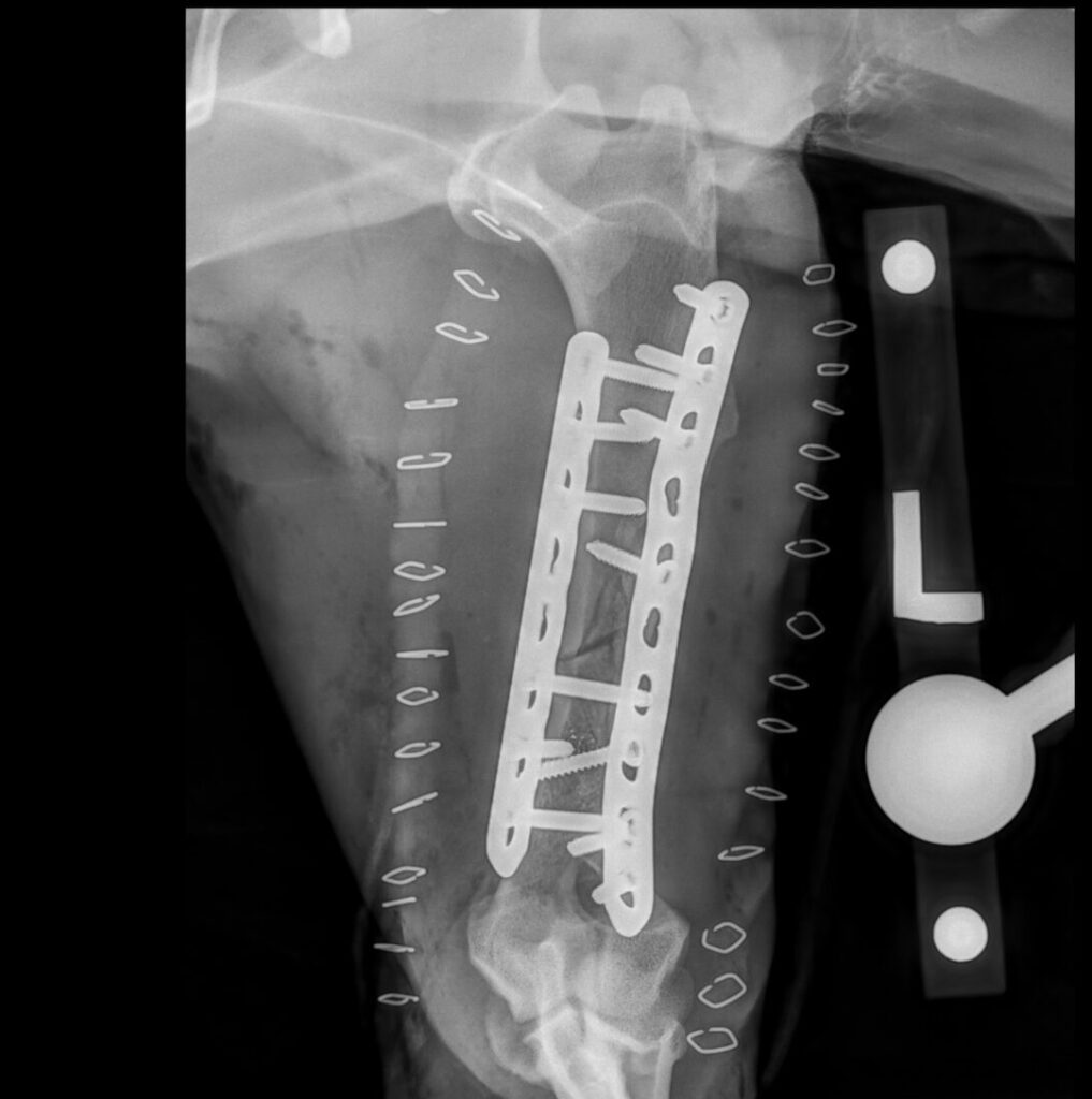 After x-rays of a fractured left humerus