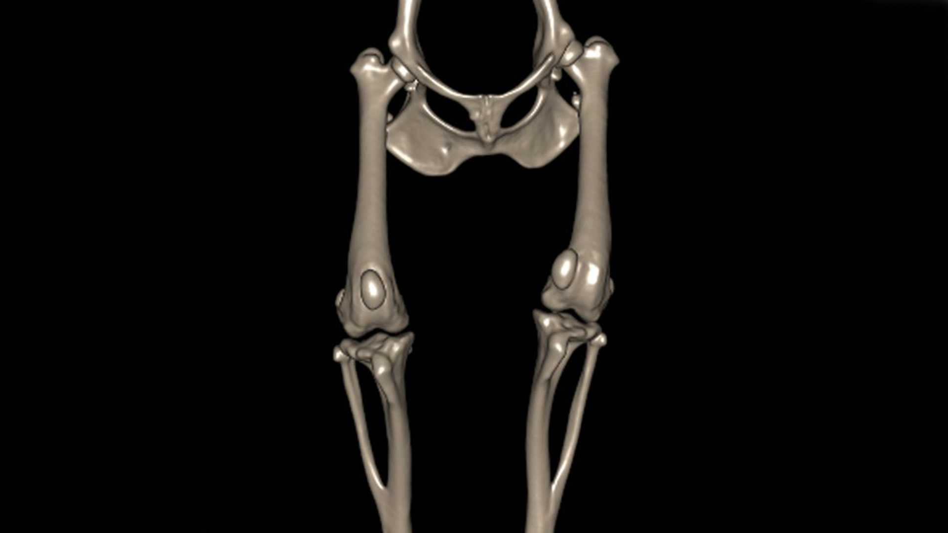 3D reconstruction of CT scan of medial patellar luxation in a dog