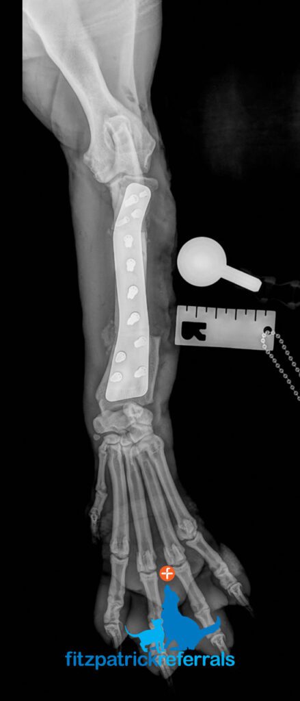 Radiograph of dog immediately after antebrachial growth deformity correction surgery