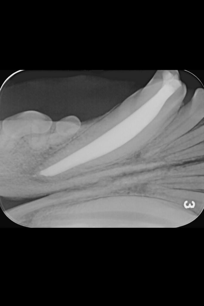 Intraoral radiograph showing the final filling of the completed root canal treatment in a mandibular canine tooth.