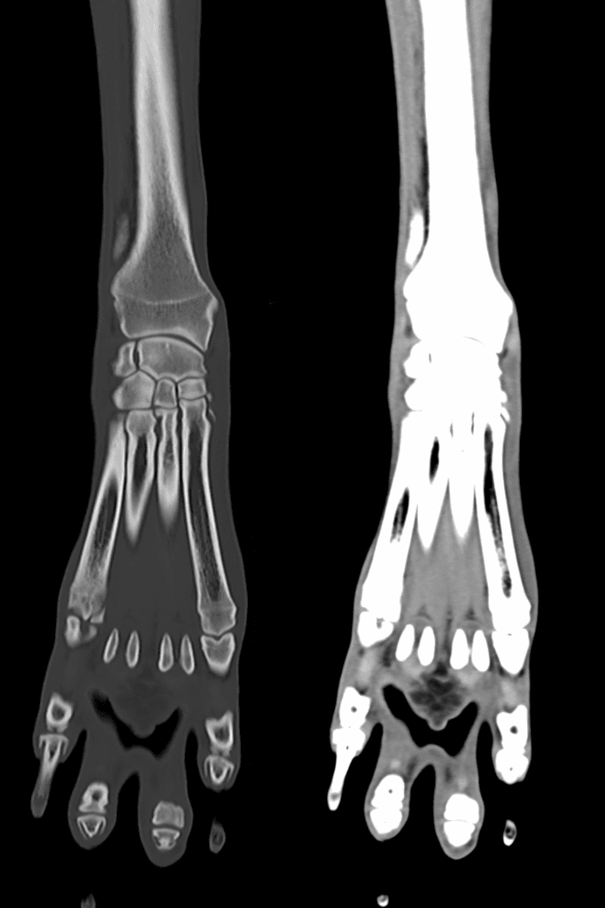 Cranial caudal CT slice of a dog's right carpus using bone and soft tissue filters.