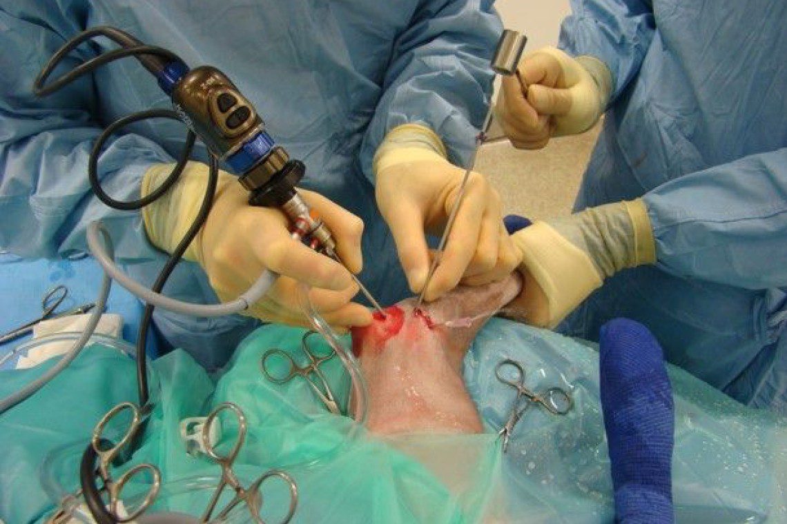 Arthroscopy of the elbow joint