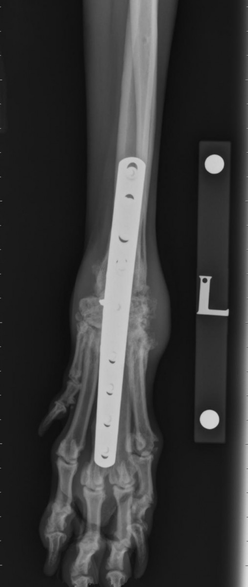 Carpal Hyperextension Fitzpatrick Referrals