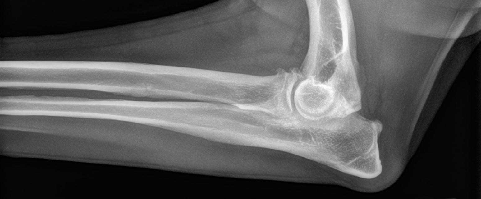 how to treat elbow dysplasia in dogs