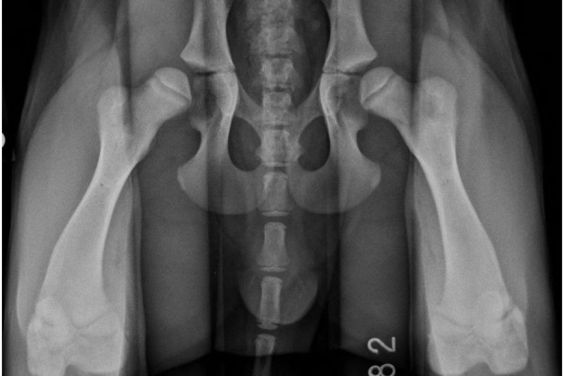 Radiograph illustrating Hip Dysplasia 