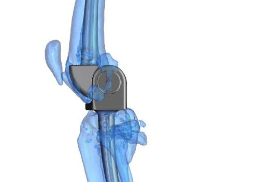 Illustration of Feline Total Knee Replacement