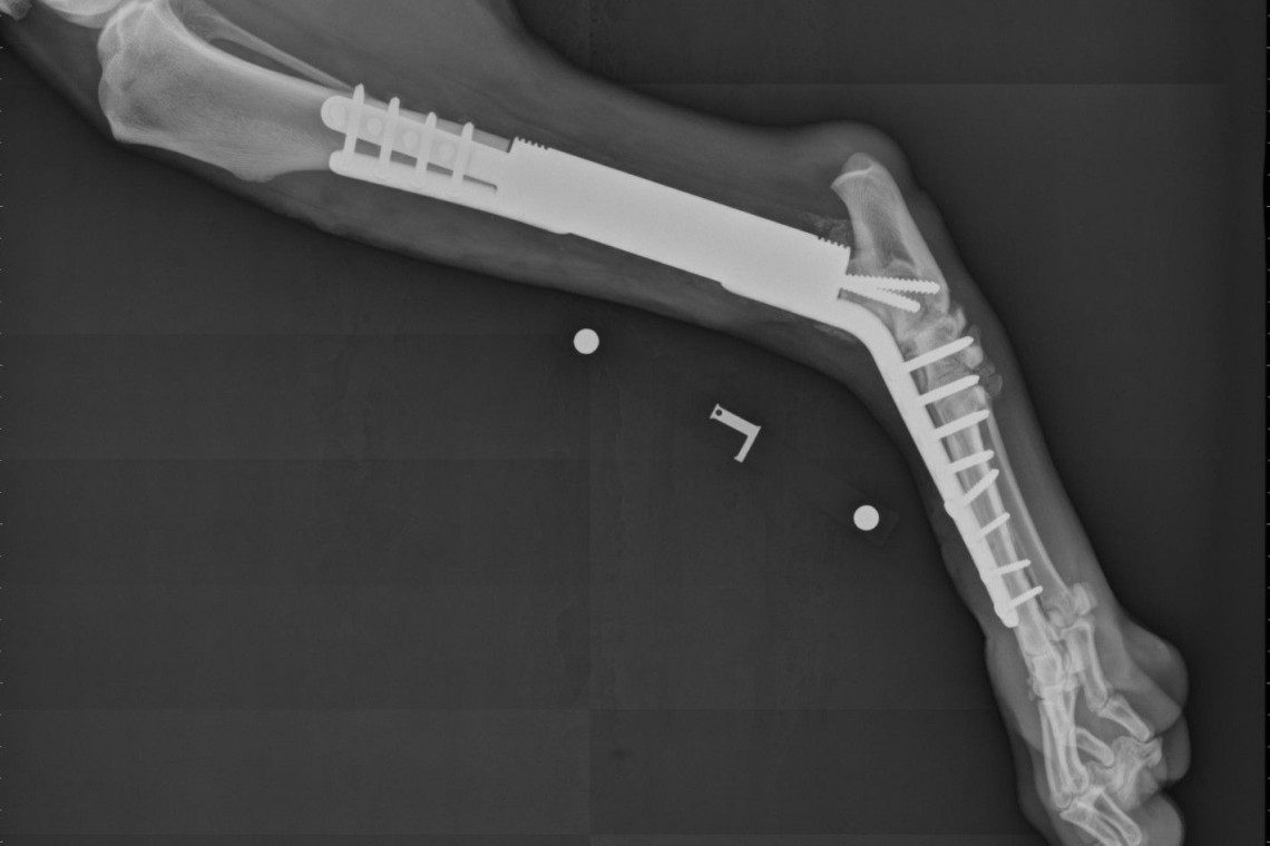 Tibial endoprosthesis post-op radiograph