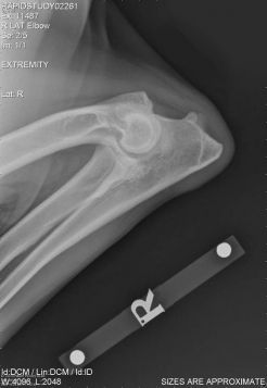 how to treat elbow dysplasia in dogs