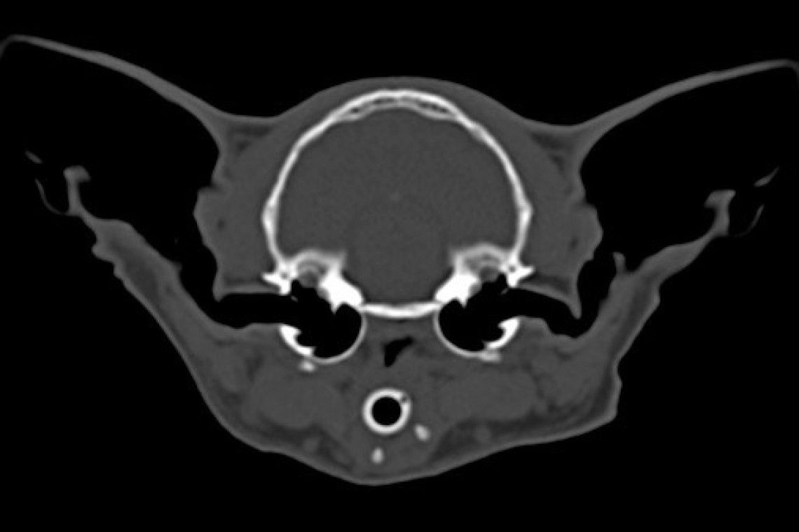 CT scan highlighting the complex vestibular system