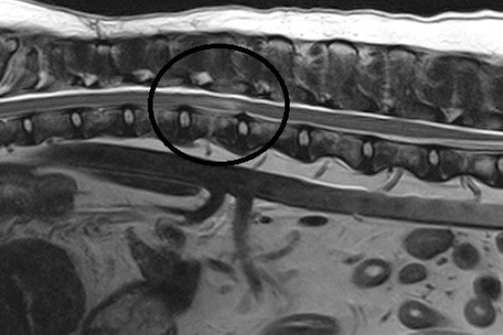 Sagittal MRI image indicating FCE in the thoracolumbar spine