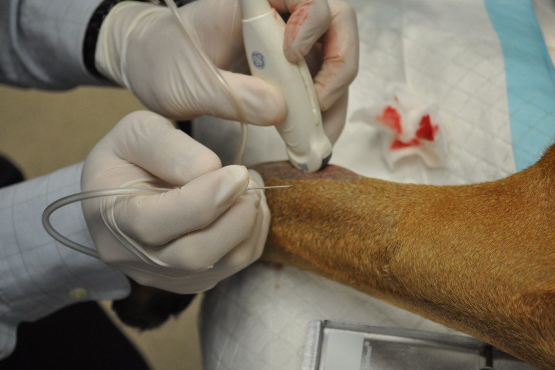 Ultrasound guided bone cell aspiration