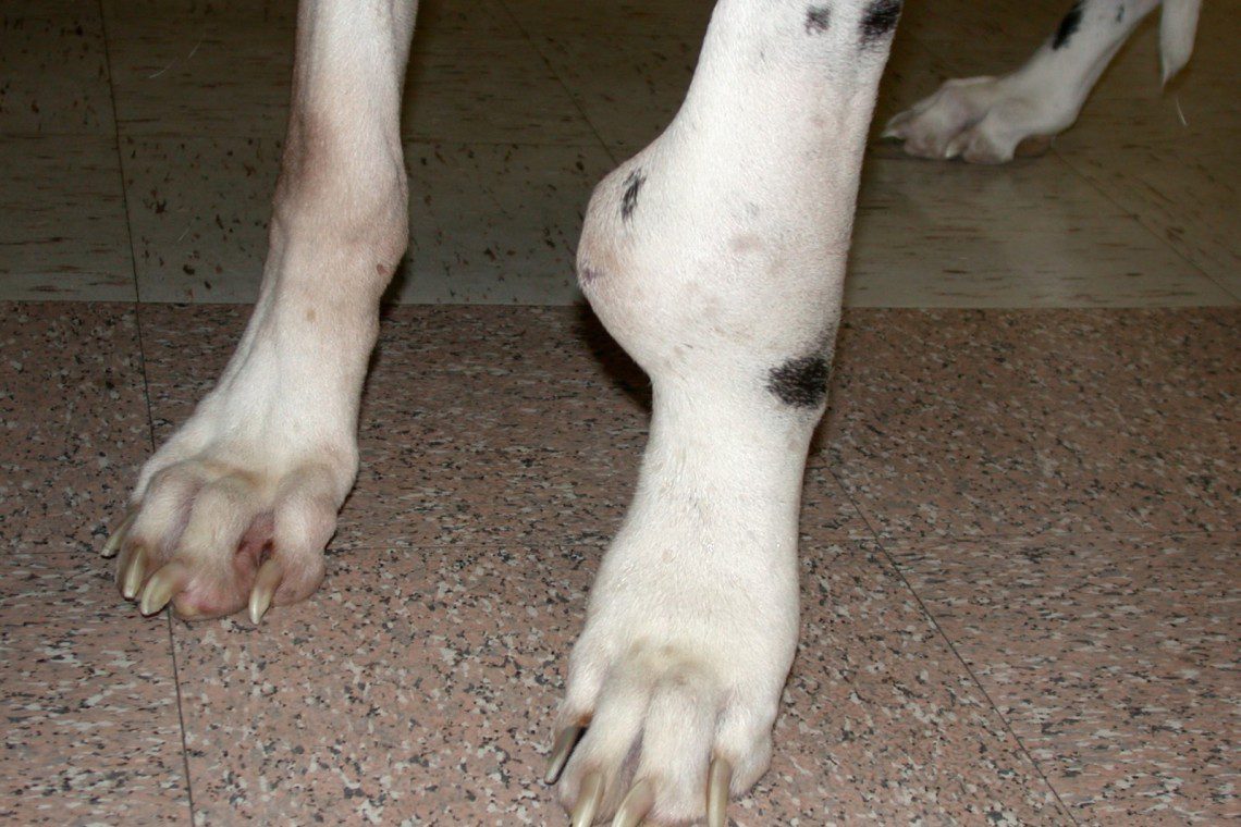 Swelling of the distal radius caused by osteosarcoma
