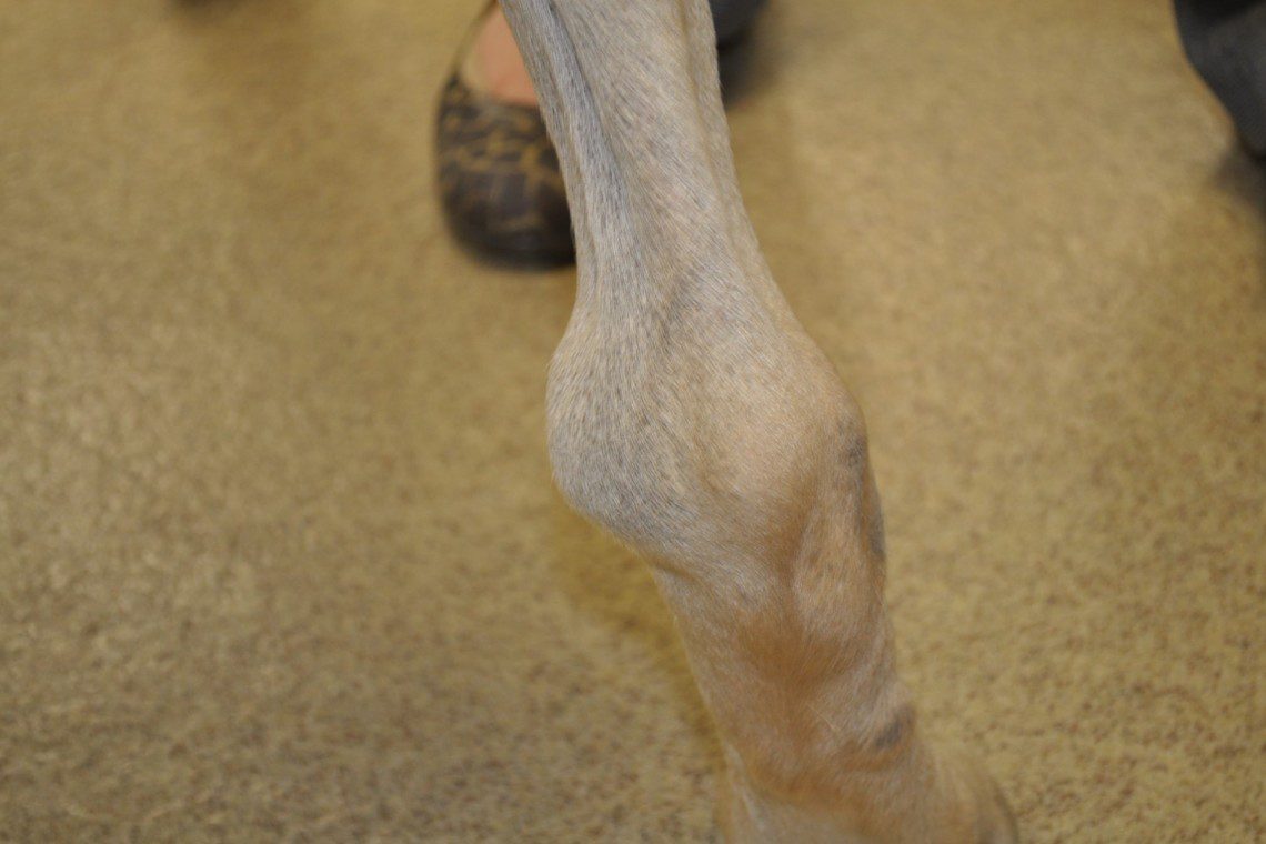 Swelling of the distal tibia caused by osteosarcoma