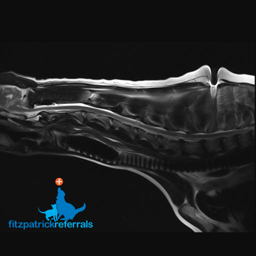 MRI scan of Ellie's neck