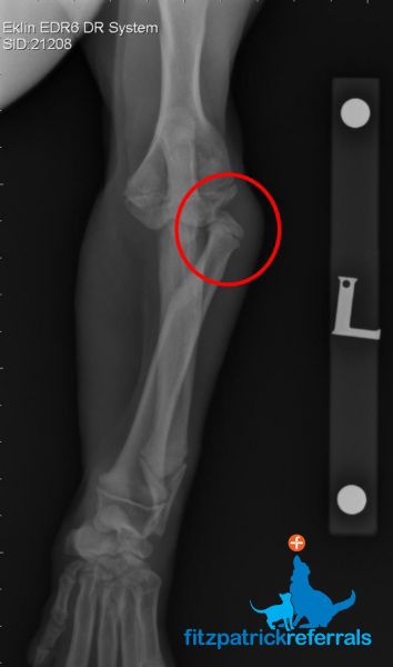 Radiograph showing Jasper's luxated radial head