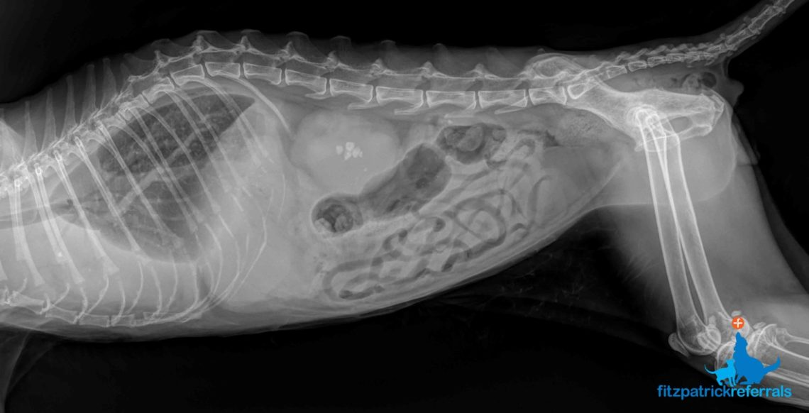 image of kidney stone on ultrasound