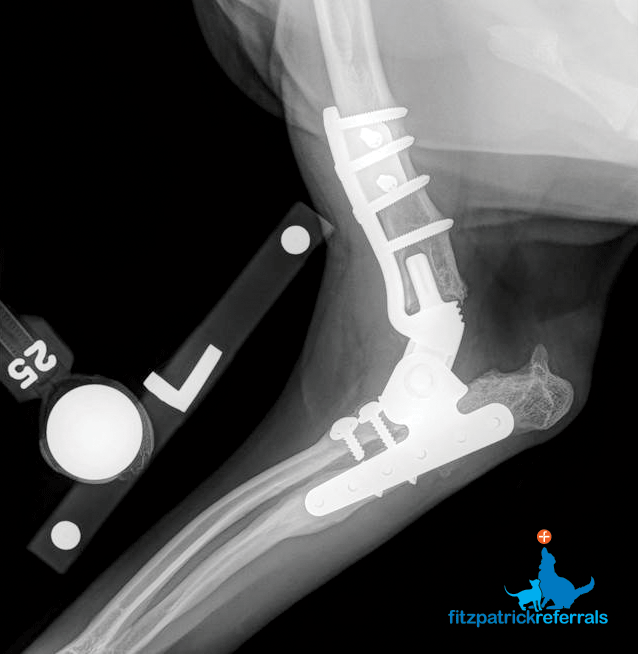 Radiograph of a custom hinged total elbow replacement. Radiograph of a custom hinged total elbow replacement Fitzpatrick Referrals