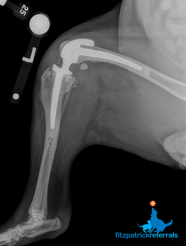 Radiograph custom hinged total knee replacement Fitzpatrick Referrals