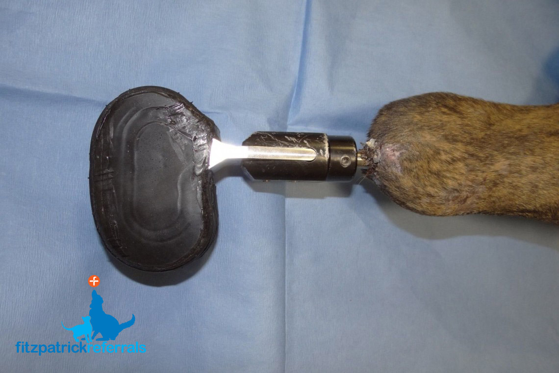 Amputation prothesis