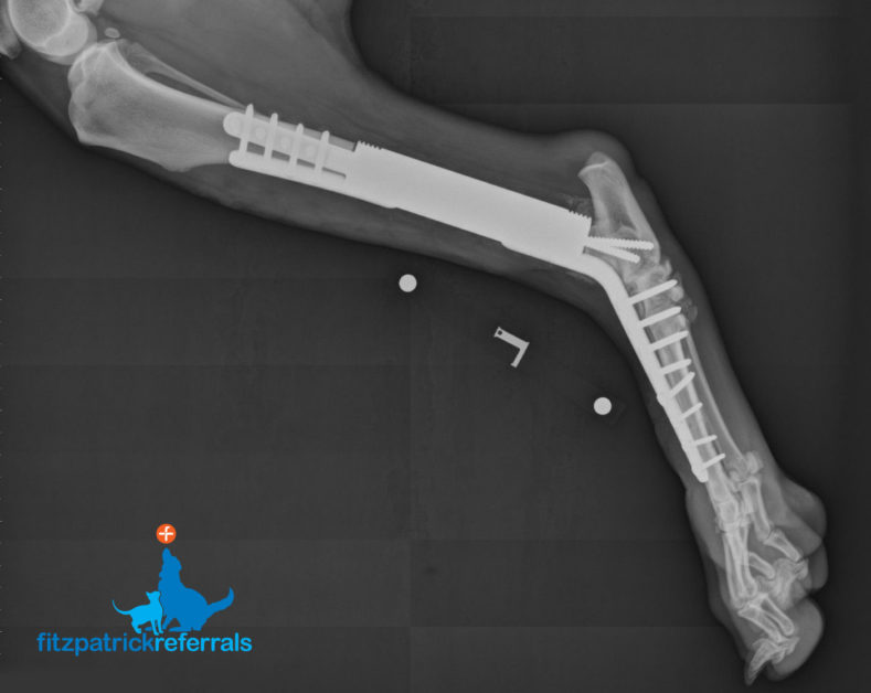 Tibial endoprosthesis post-op radiograph