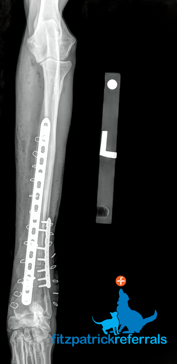Post-op x-rays following surgery