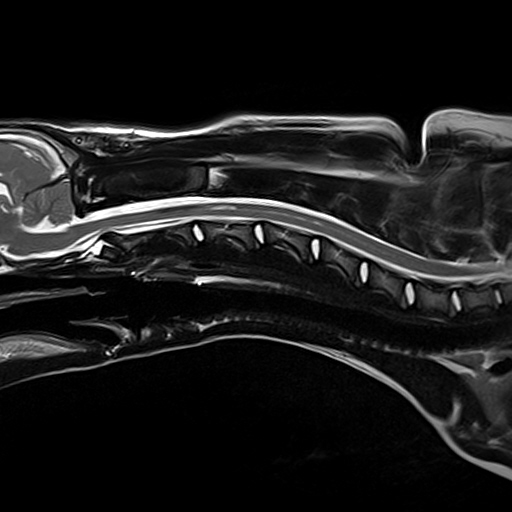 MRI scan of a 6-month-old puppy's spine 5 weeks post-surgery for hydrocephalus at Fitzpatrick Referrals showing the syringomyelia (fluid-filled cavities) have mostly resolved