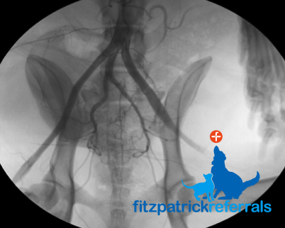 prostatitis vagy osteochondrosis