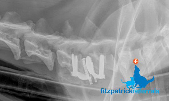 A radiograph of a custom-made Fitz-Disc