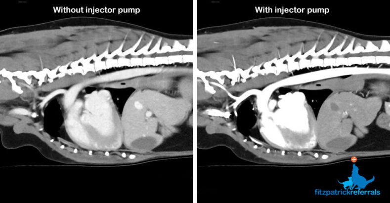 CT scan of thorax with and without injector pump by Fitzpatrick Referrals