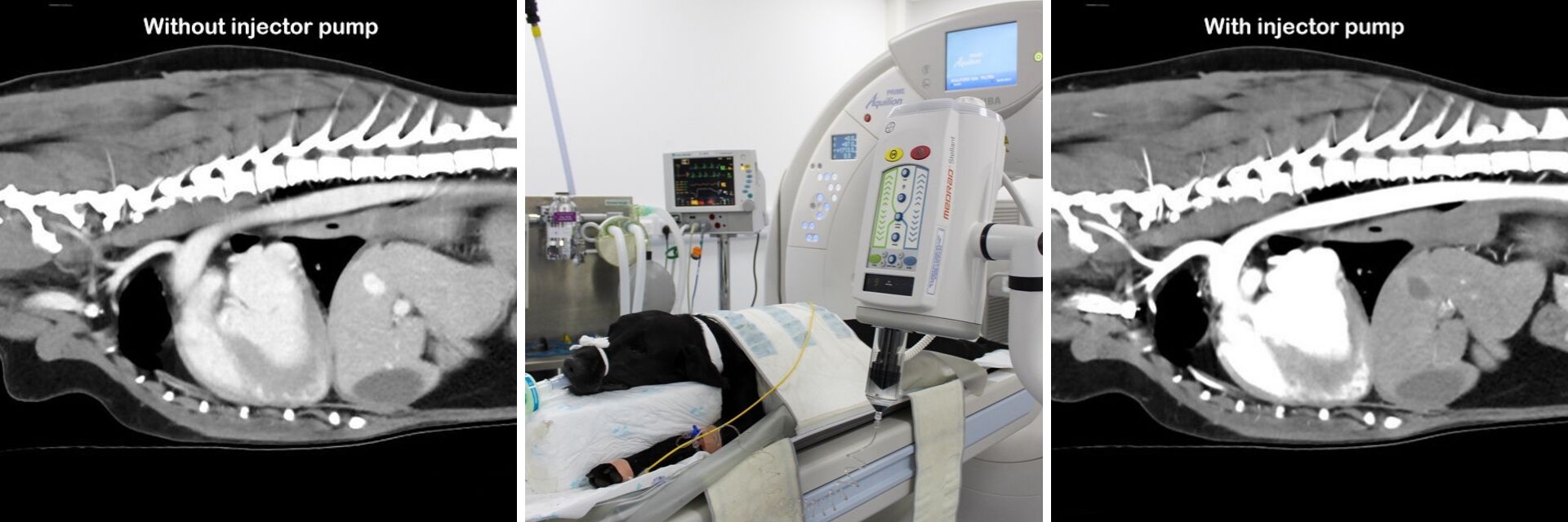CT scan of thorax with and without injector pump by Fitzpatrick Referrals