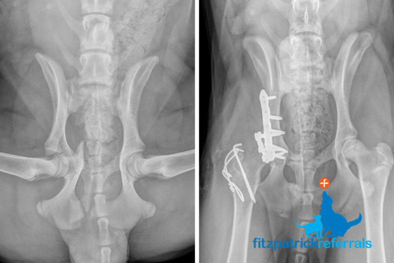 Radiograph of a pelvic fracture before and after specialist surgery