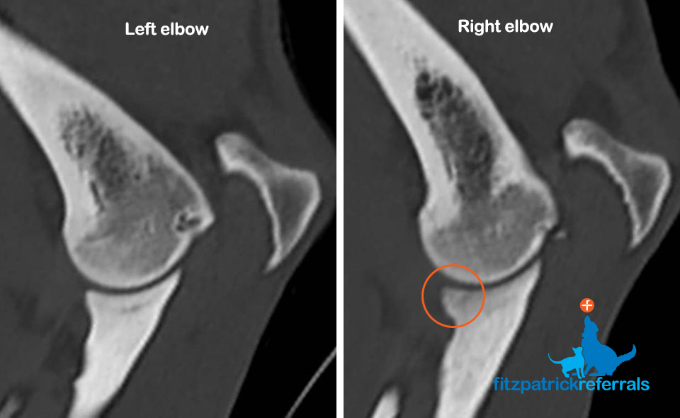 CT scan Rosie elbows