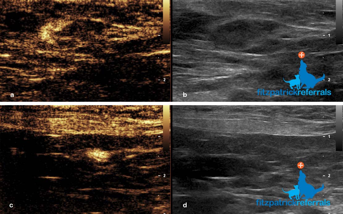 Contrast-enhanced ultrasound sentinel lymph node mapping