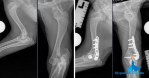 Pre and post-operative radiographs