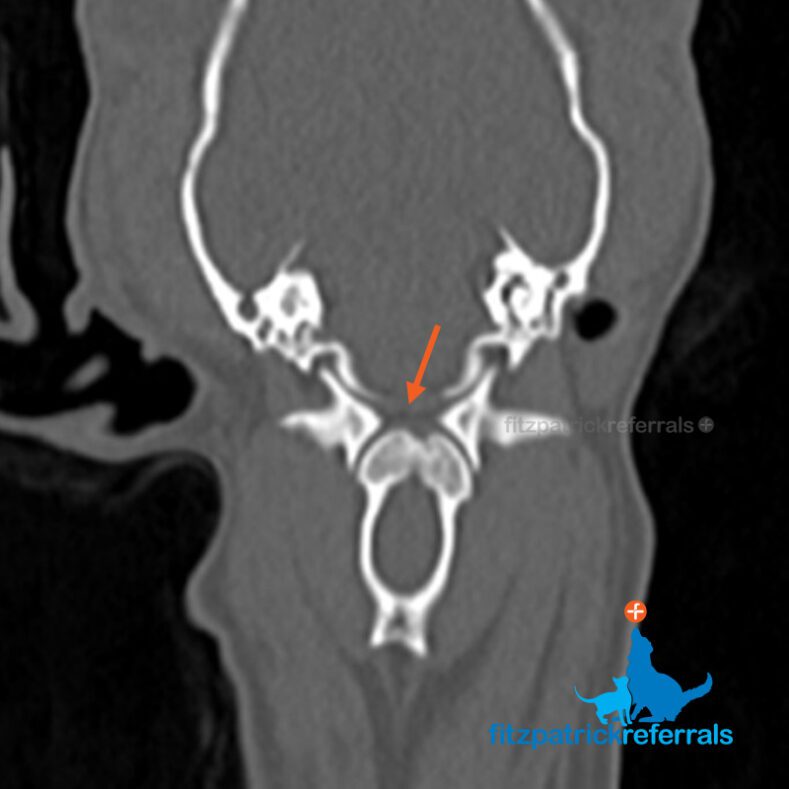 Pre-operative CT scan of a dog with atlanto-axial subluxation with absent dens