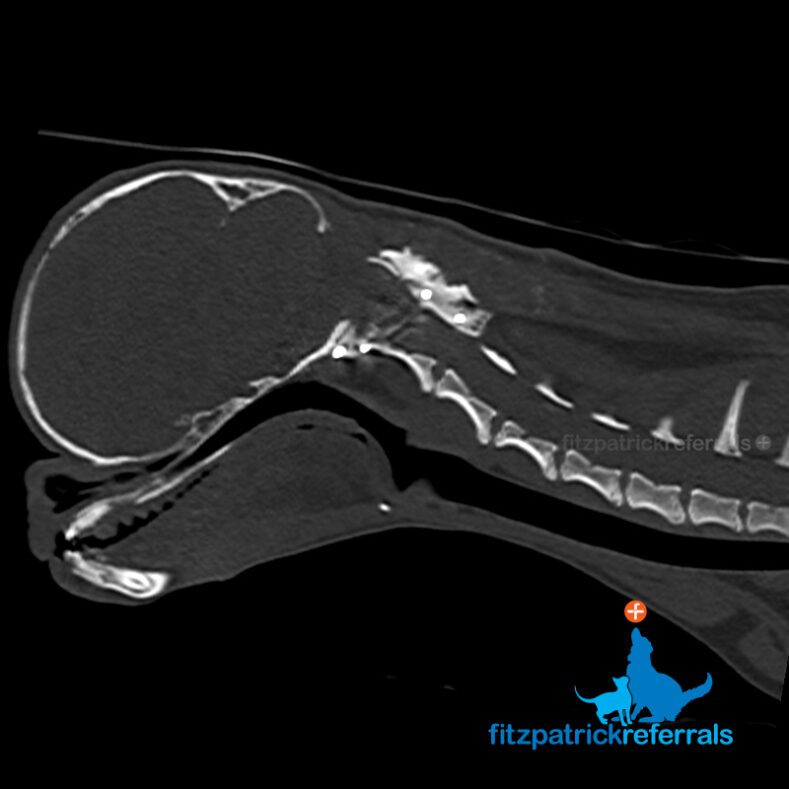 Postoperative CT scan of a dog following spinal stabilisation surgery for atlanto-axial subluxation with absent dens.