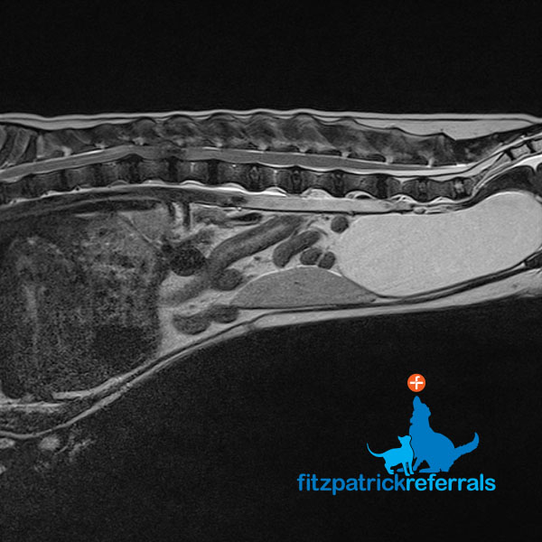 MRI scan of a 5 year old Dachshund with Hansen Type 1 IVD Extrusion