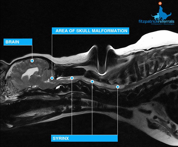 Syringomyelia Fitzpatrick Referrals