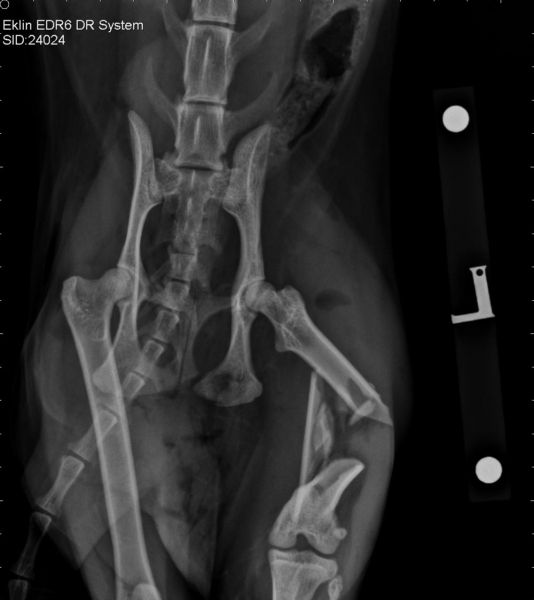 Lara's fractured thigh bone. Lara